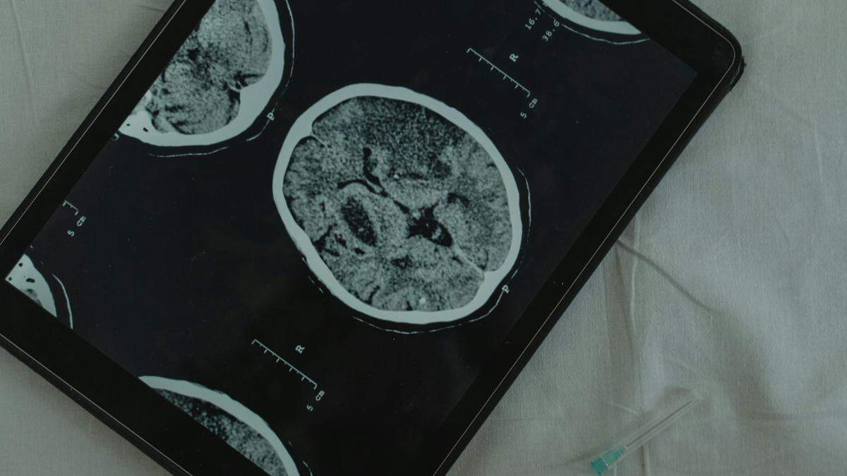 Mental illness is on the rise nationally and care can be hard to obtain.
