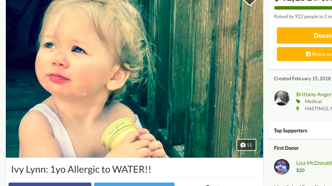 Ivy's mom started a GoFundMe page to help offset medical costs for Ivy's condition.