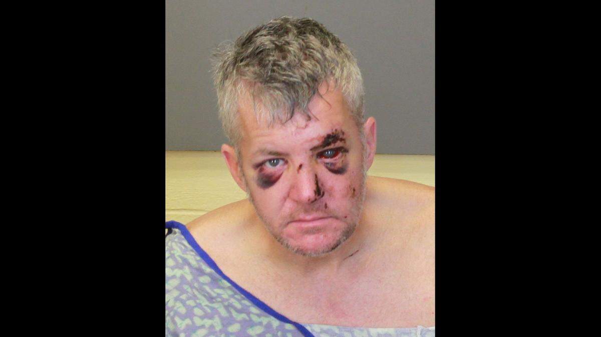 William Talley’s mugshot, taken after his release from Piedmont Columbus Regional hospital. He was admitted after after wrecking the truck of paramedic Kelly Levinsohn the night she was shot and killed.