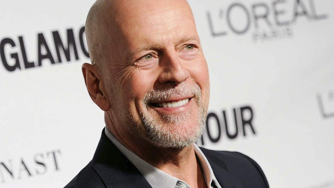Bruce Willis has aphasia. Here’s how USC has researched ways to recover for years