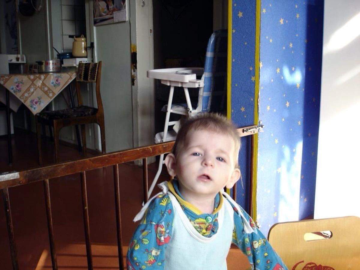 Kelsey was 11 months old – and weighted less than 14 pounds -- when Carol Norris met her at a Russian orphanage. Carol said she still in love with Kelsey at first sight and adopted her three months later.