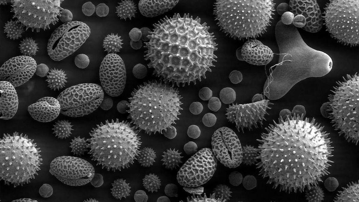 Grains of pollen seen through a scanning electron microscope.
