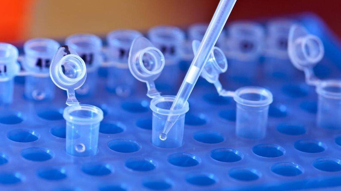 DNA tests reveal the obvious — I am a really white guy