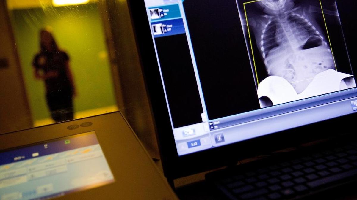 A radiology technician looks at a chest X-ray of a child suffering from flu symptoms at Upson Regional Medical Center in Thomaston, Ga., Friday, Feb. 9, 2018.