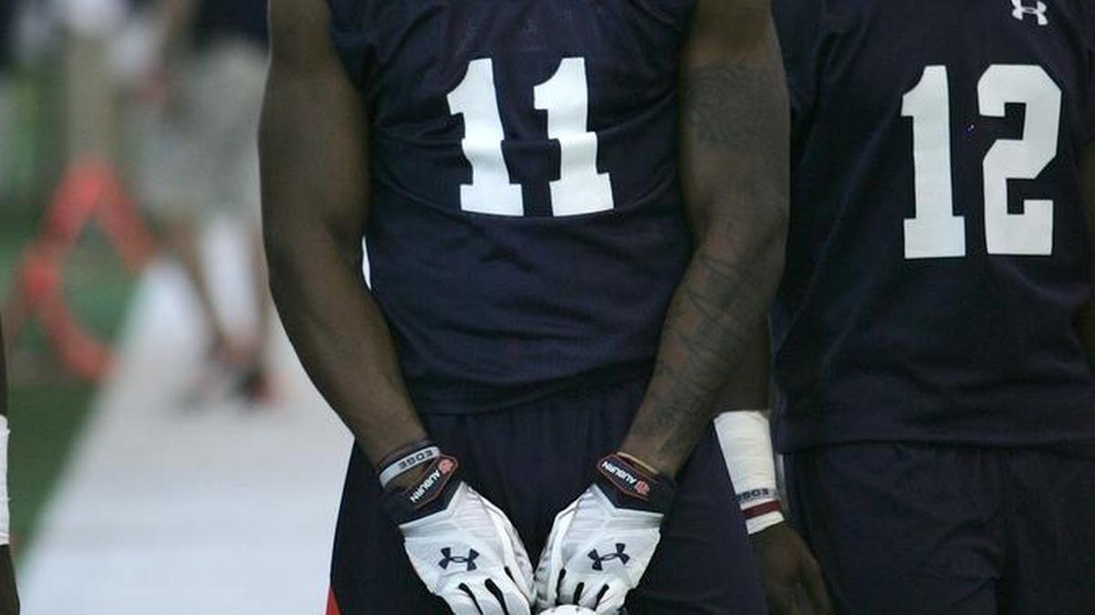 Auburn wide receiver Kyle Davis sits out practice Wednesday, August 3, 2016.
